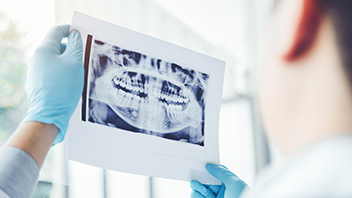 kieferorthopaedische-behandlung-kl